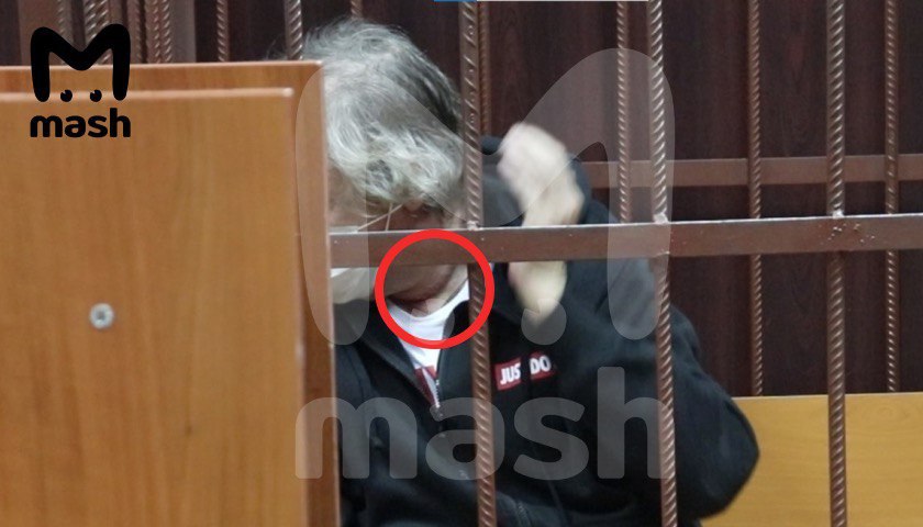 Борозда на шее у Ефремова была хорошо заметна