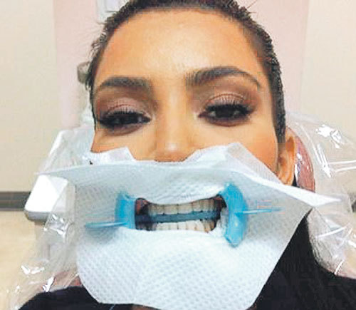 Процесс профессиональной чистки зубов Ким КАРДАШЯН выложила в своем блоге в Twitter. Поклонники шутят: следующим снимком актрисы будет селфи из кабинета гинеколога?