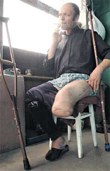 ИВАН ДОРОХИН: у бывшего раба сейчас нет денег даже на самый дешевый протез